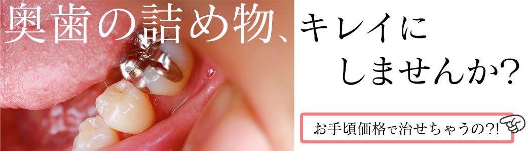 インレー