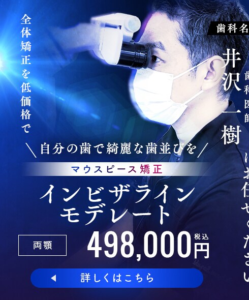 モニター募集　インビザラインモデレート