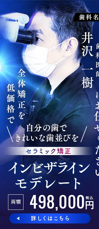 モニター募集　インビザラインモデレート
