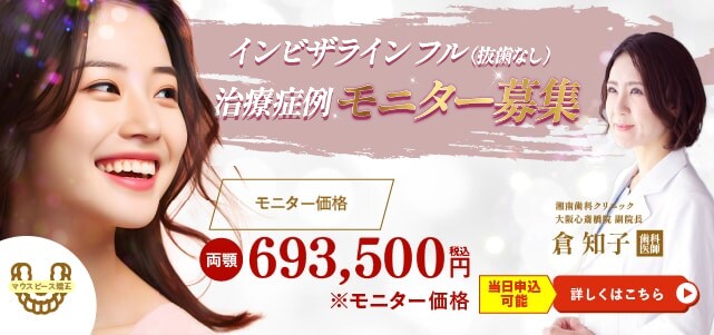 インビザラインフルモニターバナー