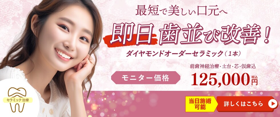 ダイヤモンドオーダーセラミックモニターバナー