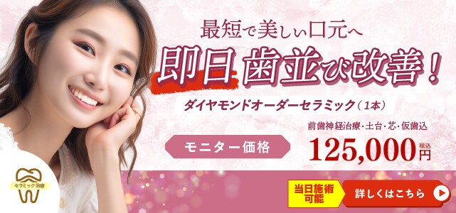 ダイヤモンドオーダーセラミックモニターバナー
