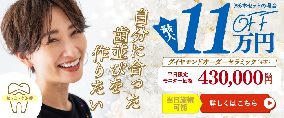 11万円OFF ダイヤモンドオーダーセラミック