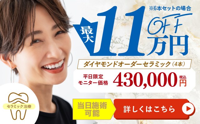 11万円OFF ダイヤモンドオーダーセラミック