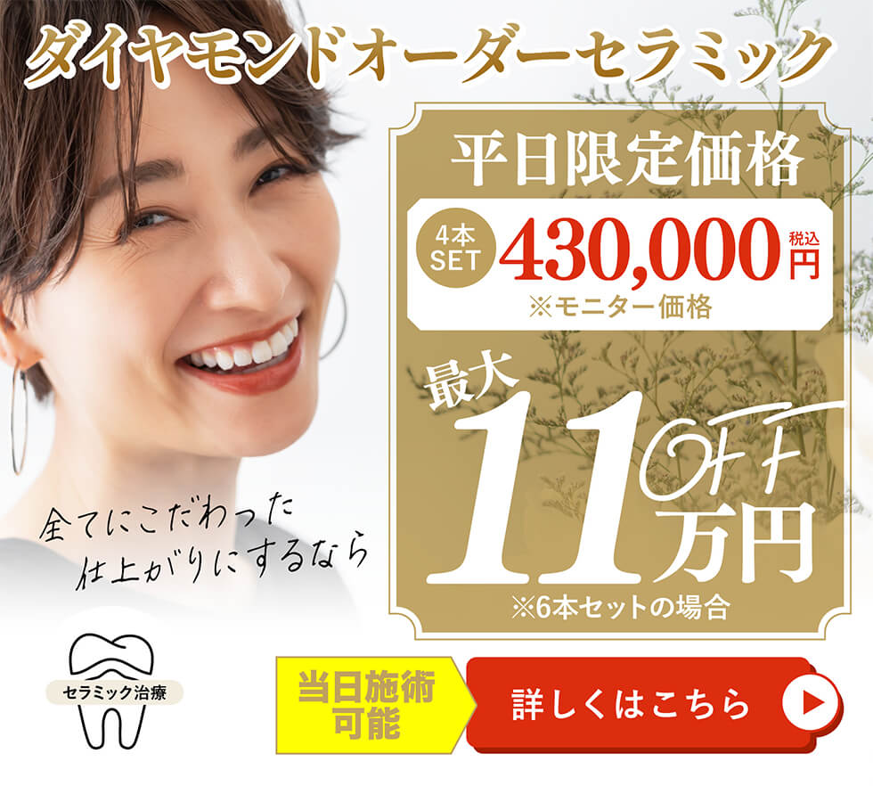 ダイヤモンドオーダーセラミックモニター