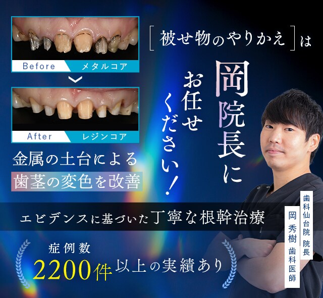 マウスピース矯正大感謝祭