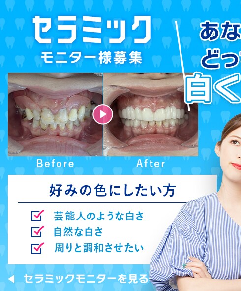 セラミックモニタ