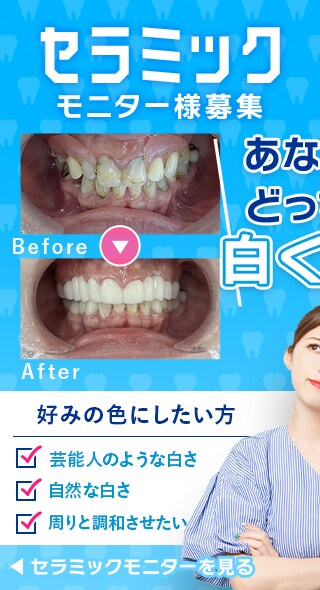 セラミックモニター