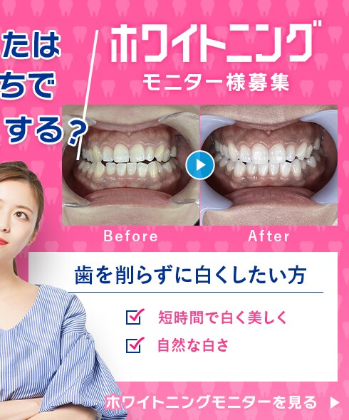 ホワイトニングモニター