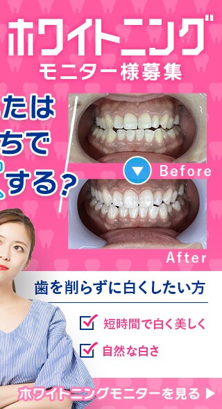ホワイトニングモニター