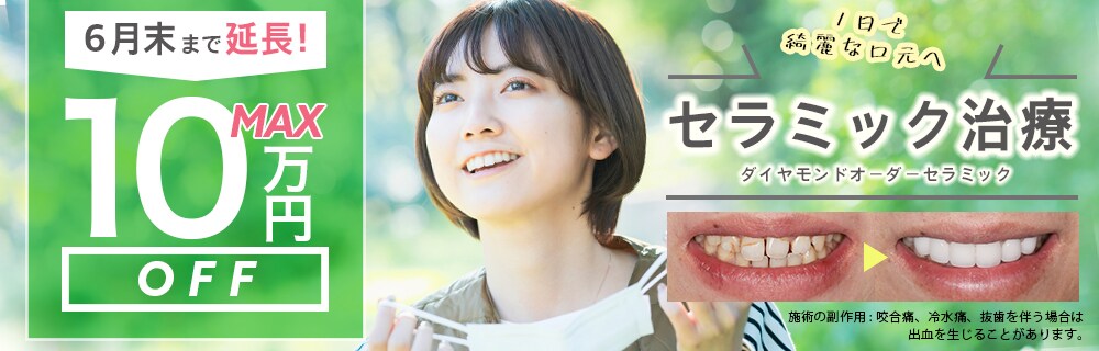 最大10万円オフ