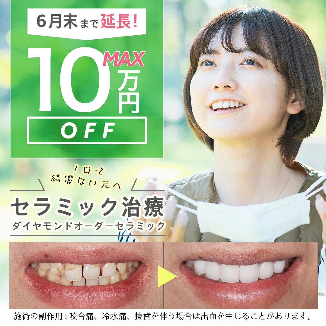 最大10万円オフ