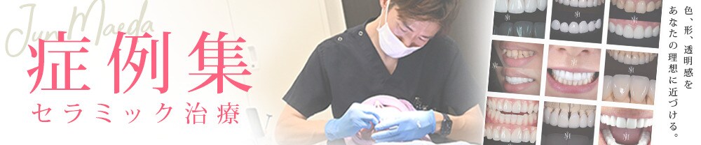 症例数 セラミック治療