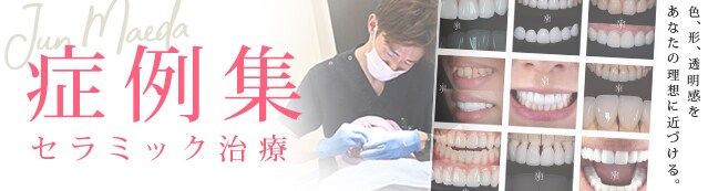 症例数 セラミック治療