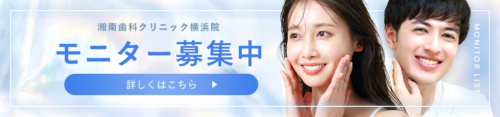 モニター募集
