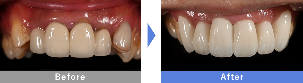 伊藤医師症例１
