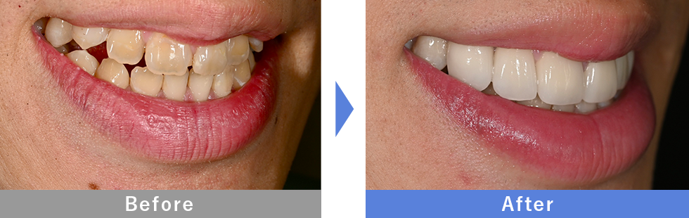 伊藤医師症例２