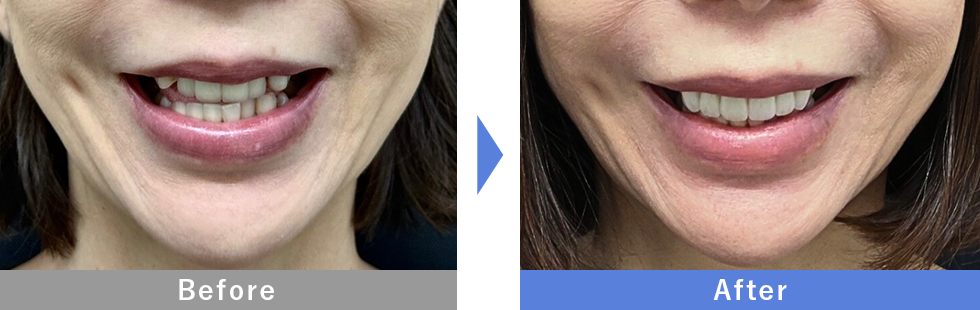 伊藤医師症例３