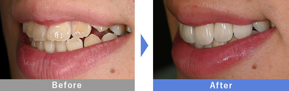 伊藤健医師症例2