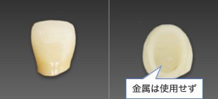 プレミアムダイヤモンドセラミックの歯
