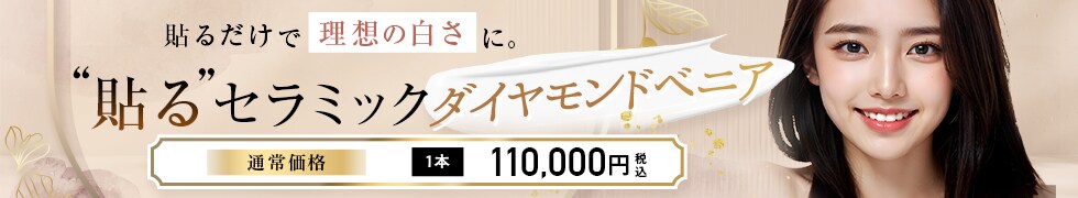 ダイヤモンドベニア