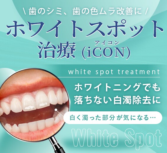 ホワイトスポット治療（iCON）