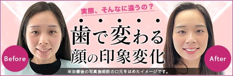 歯並びで顔の印象はここまで変わる！