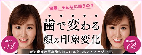 歯並びで顔の印象はここまで変わる！