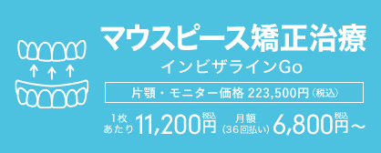 マウスピース矯正