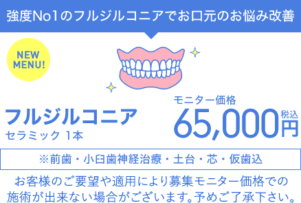フルジルコニア