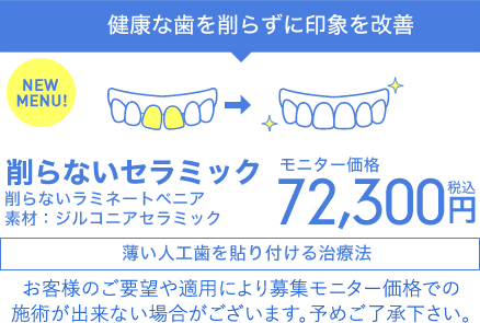 削らないラミネートべニア