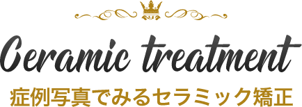 見てわかるセラミック矯正