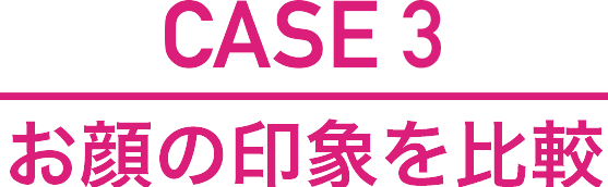 歯並びで顔の印象はここまで変わる 湘南美容歯科 歯並びで顔の印象はここまで変わる 湘南美容歯科
