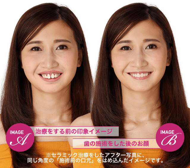 歯並びで顔の印象はここまで変わる 湘南美容歯科