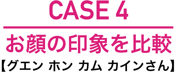 歯並びで顔の印象はここまで変わる 湘南美容歯科 歯並びで顔の印象はここまで変わる 湘南美容歯科