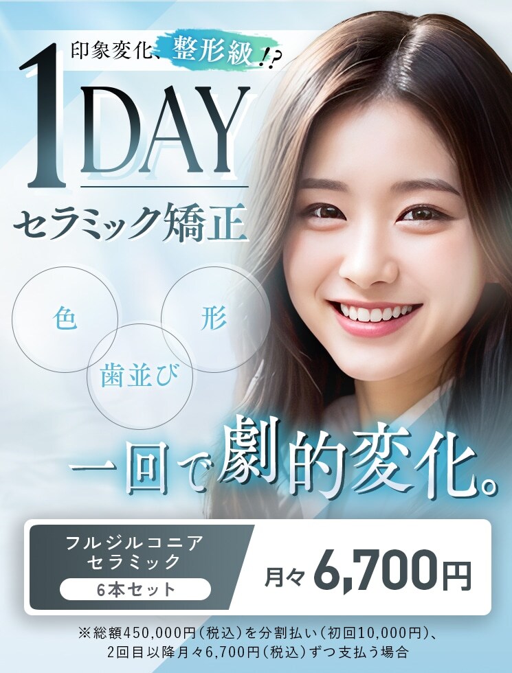 1dayセラミック