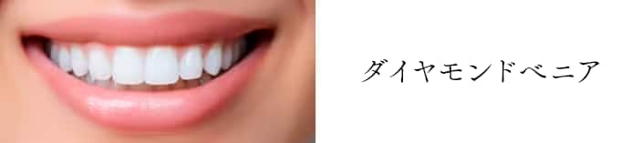 ダイヤモンドベニア