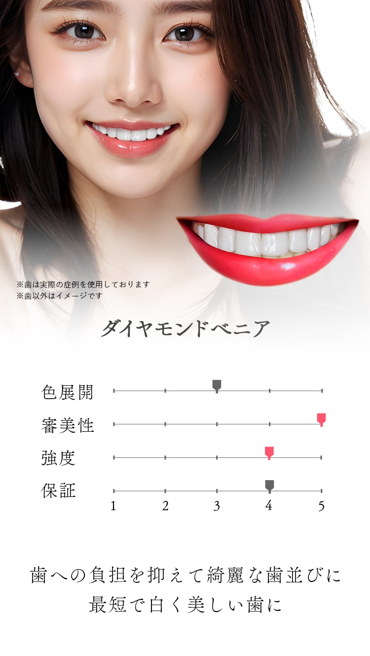 ダイヤモンドベニヤ