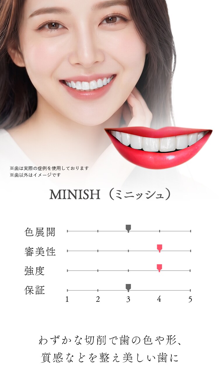 MINISH