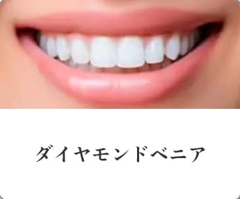 ダイヤモンドベニア