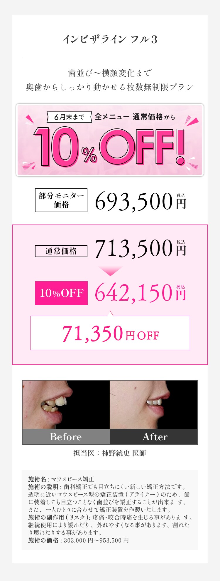 インビザラインフル3 料金