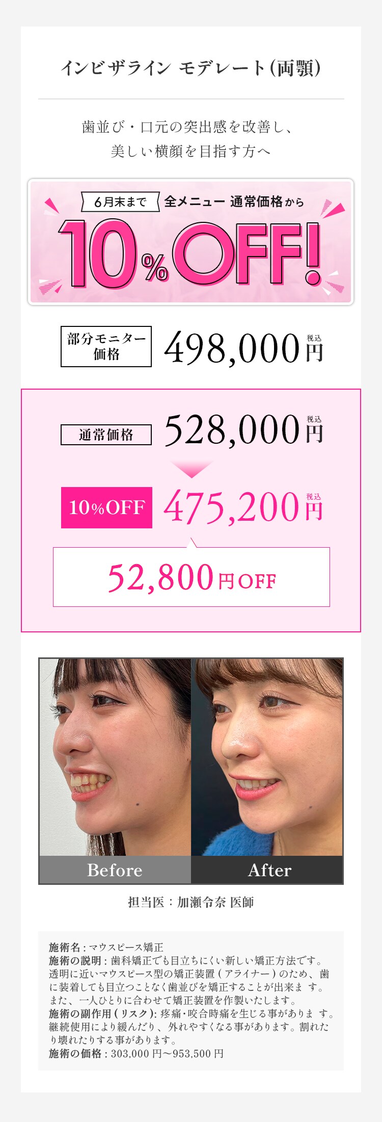 インビザラインモデレート 料金