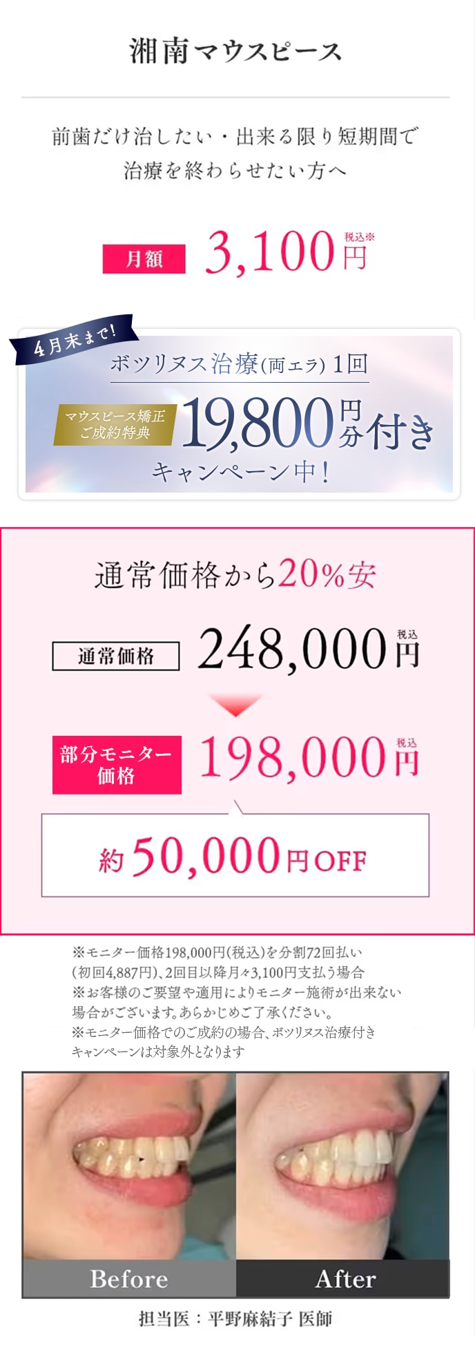 湘南マウスピース 料金