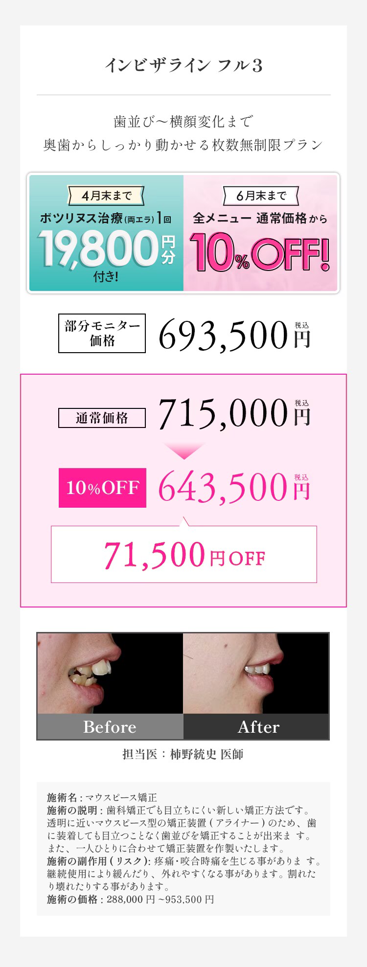 インビザラインフル3 料金