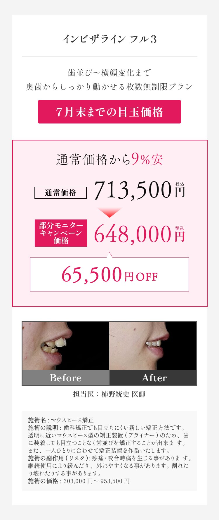 インビザラインフル3 料金