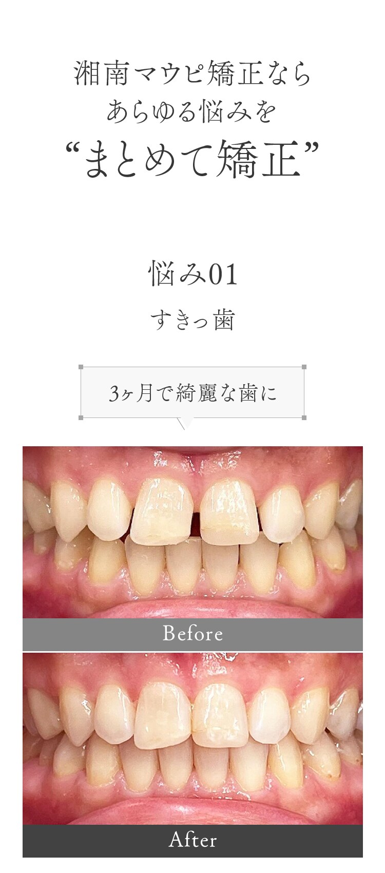 すきっぱ