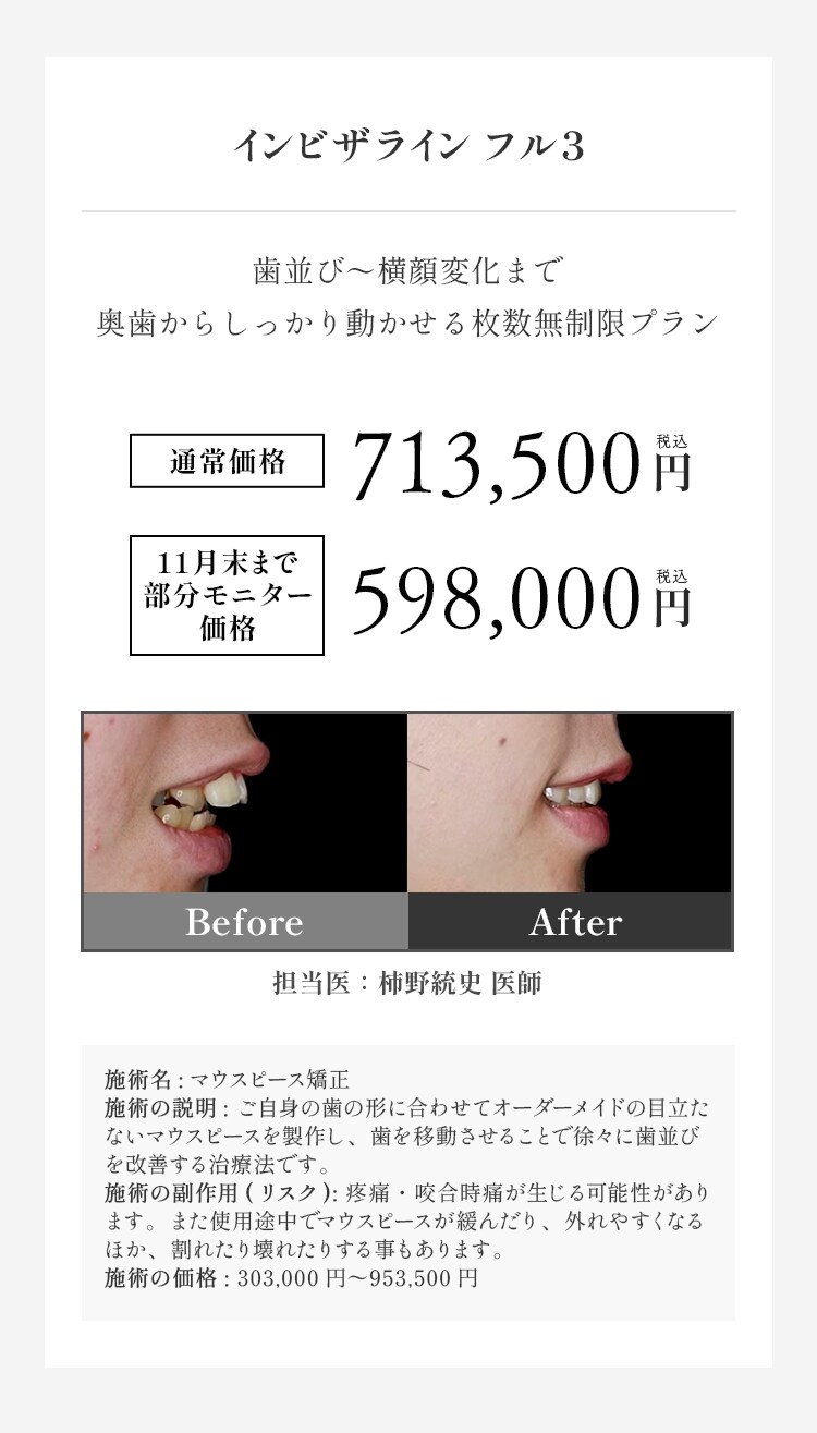 インビザラインフル3 料金