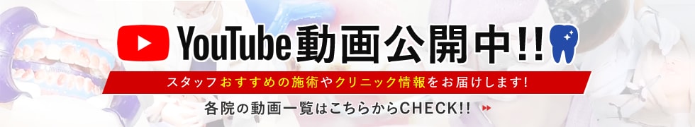 ホワイトニングライブ配信★実際にホワイトニング受けてみた!!