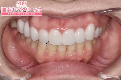 After