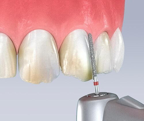 step02 ドクター・カウンセラーとのカウンセリング